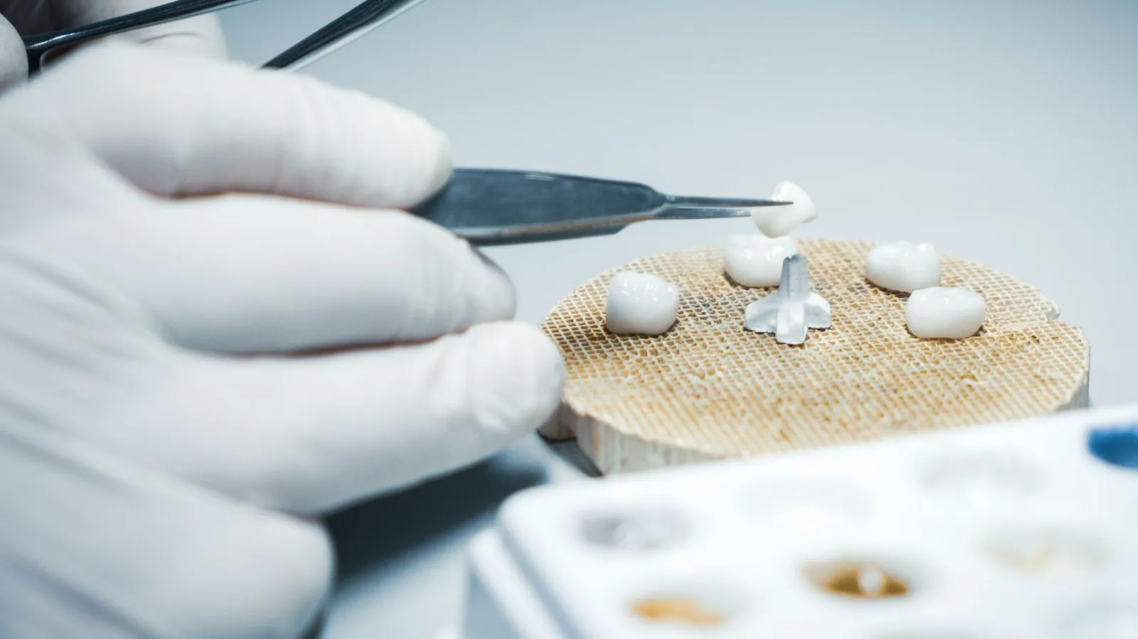 dental crowns