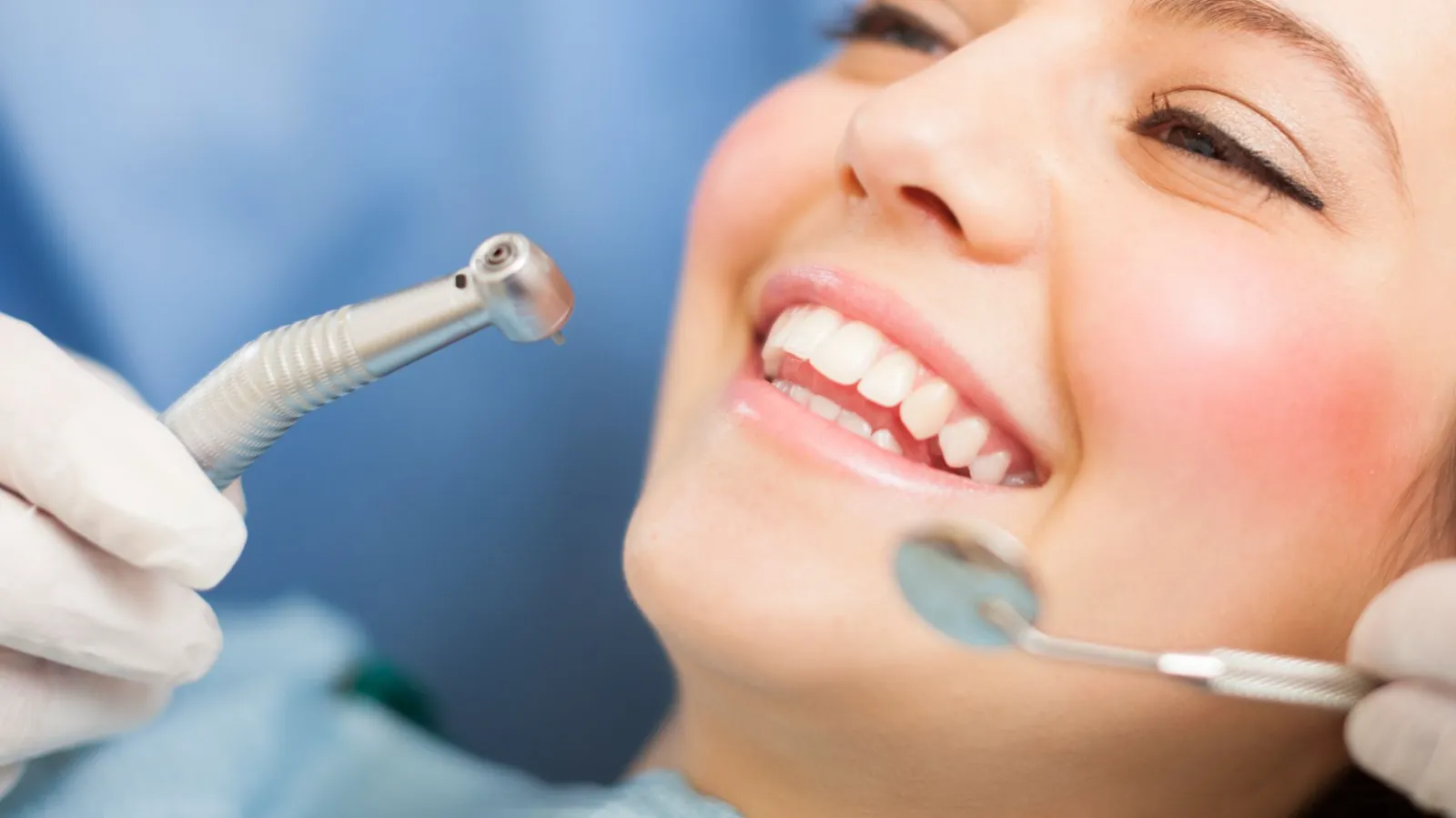 dental fillings